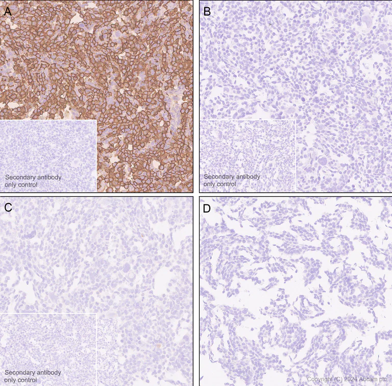 Immunohistochemistry (Formalin/PFA-fixed paraffin-embedded sections) - Anti-Neuroligin 2 antibody [RM2048] (AB317510)