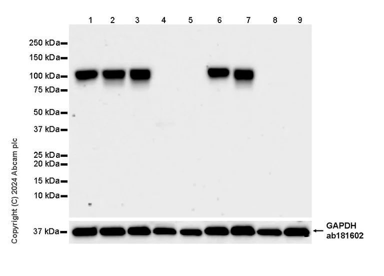 Western blot - Anti-Neuroligin 2 antibody [RM2048] (AB317510)