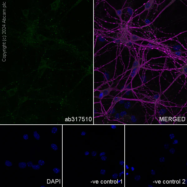 Immunocytochemistry/ Immunofluorescence - Anti-Neuroligin 2 antibody [RM2048] - BSA and Azide free (AB317511)