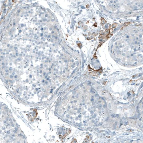 Immunohistochemistry (Formalin/PFA-fixed paraffin-embedded sections) - Anti-Neuroligin 3 antibody (AB244265)
