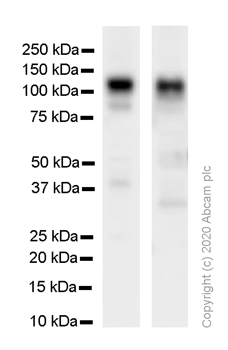 Western blot - Anti-Neuroligin 3 antibody [EPR16158] - BSA and Azide free (AB251161)