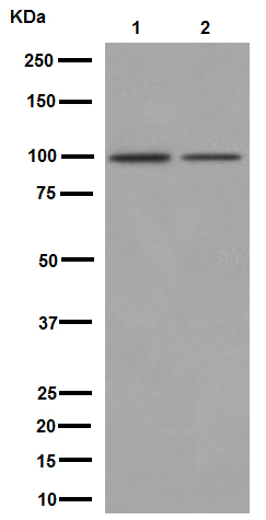 Western blot - Anti-Neuroligin 3 antibody [EPR16158] - BSA and Azide free (AB251161)