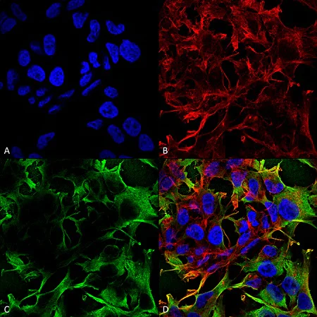 Immunocytochemistry/ Immunofluorescence - Anti-Neuroligin 3 antibody [N110/29] (AB186307)
