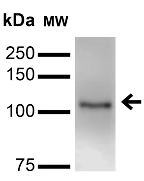 Western blot - Anti-Neuroligin 3 antibody [N110/29] (AB186307)