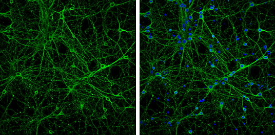 Immunocytochemistry/ Immunofluorescence - Anti-Neuron specific beta III Tubulin antibody - Neuronal Marker (AB229590), expandable thumbnail