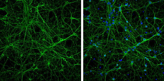 Immunocytochemistry/ Immunofluorescence - Anti-Neuron specific beta III Tubulin antibody - Neuronal Marker (AB229590)