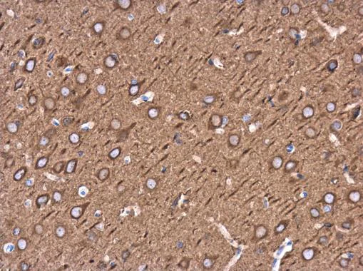 Immunohistochemistry (Formalin/PFA-fixed paraffin-embedded sections) - Anti-Neuron specific beta III Tubulin antibody - Neuronal Marker (AB229590)