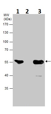 Immunoprecipitation - Anti-Neuron specific beta III Tubulin antibody - Neuronal Marker (ab229590), expandable thumbnail