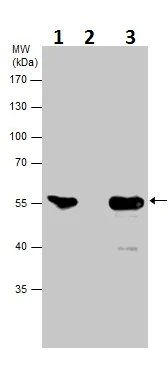 Immunoprecipitation - Anti-Neuron specific beta III Tubulin antibody - Neuronal Marker (AB229590)
