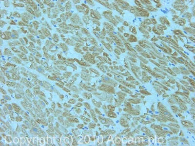 Immunohistochemistry (Formalin/PFA-fixed paraffin-embedded sections) - Anti-Neuropilin 1 antibody (AB25998)