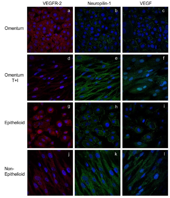 Immunocytochemistry/ Immunofluorescence - Anti-Neuropilin 1 antibody [EPR3113] (AB81321), expandable thumbnail