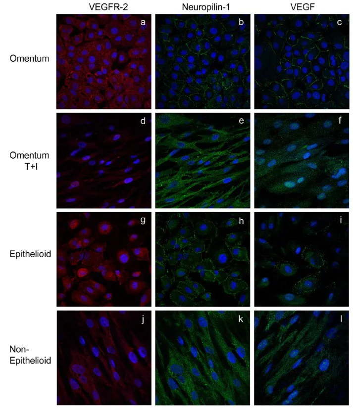 Immunocytochemistry/ Immunofluorescence - Anti-Neuropilin 1 antibody [EPR3113] (AB81321)