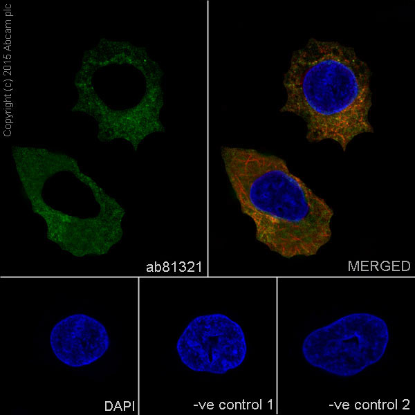 Immunocytochemistry/ Immunofluorescence - Anti-Neuropilin 1 antibody [EPR3113] (ab81321), expandable thumbnail