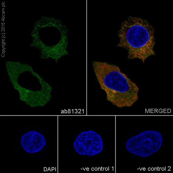 Immunocytochemistry/ Immunofluorescence - Anti-Neuropilin 1 antibody [EPR3113] (AB81321)