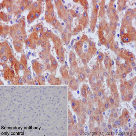 Immunohistochemistry (Formalin/PFA-fixed paraffin-embedded sections) - Anti-Neuropilin 1 antibody [EPR3113] (AB81321)