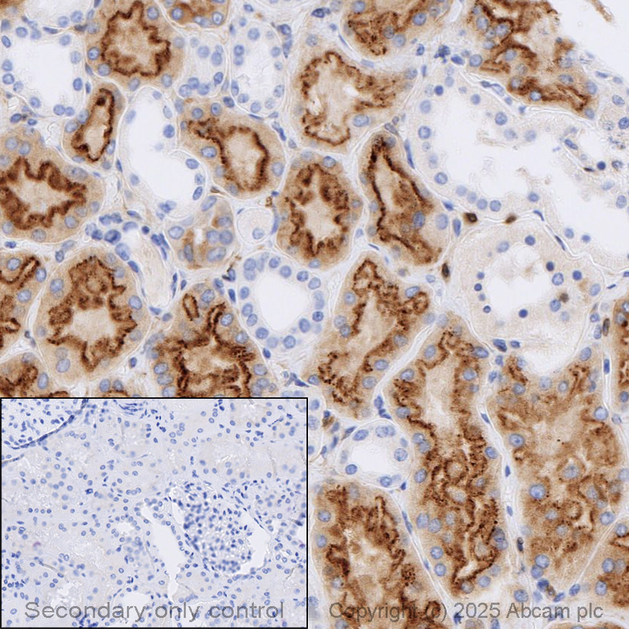 Anti-Neuropilin 1 antibody [EPR3113] (ab81321) | Abcam