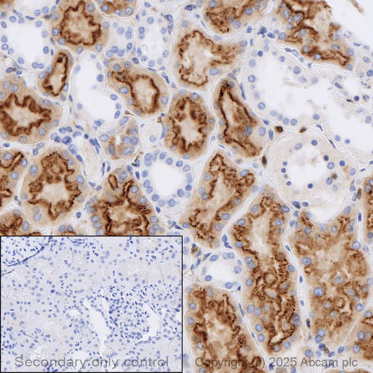 Immunohistochemistry (Formalin/PFA-fixed paraffin-embedded sections) - Anti-Neuropilin 1 antibody [EPR3113] (AB81321)
