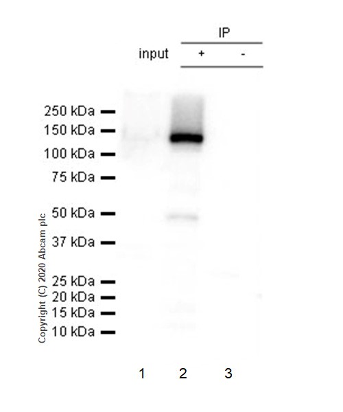 Immunoprecipitation - Anti-Neuropilin 1 antibody [EPR3113] (AB81321), expandable thumbnail