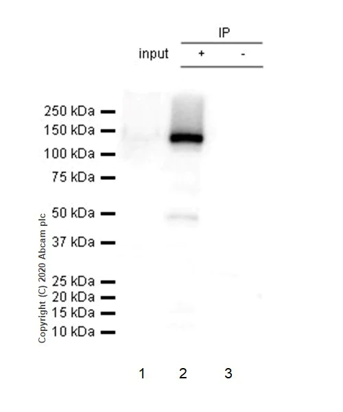 Immunoprecipitation - Anti-Neuropilin 1 antibody [EPR3113] (AB81321)