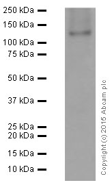 Western blot - Anti-Neuropilin 1 antibody [EPR3113] (ab81321), expandable thumbnail