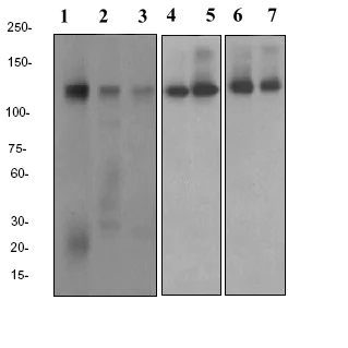 Western blot - Anti-Neuropilin 1 antibody [EPR3113] (AB81321)