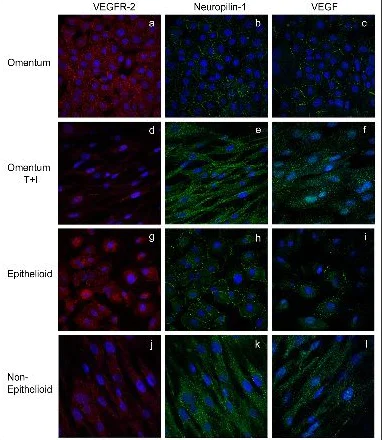 Immunocytochemistry/ Immunofluorescence - Anti-Neuropilin 1 antibody [EPR3113] - BSA and Azide free (AB184783)