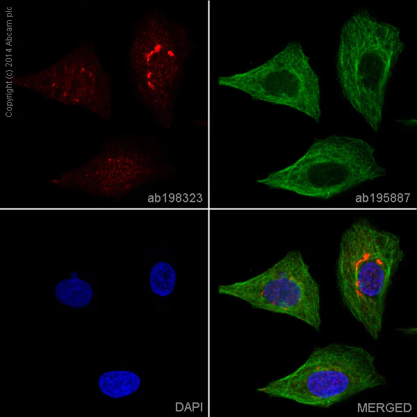 Immunocytochemistry/ Immunofluorescence - Anti-Neuropilin 1 antibody [EPR3113] - BSA and Azide free (AB184783)