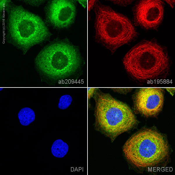 Immunocytochemistry/ Immunofluorescence - Anti-Neuropilin 1 antibody [EPR3113] - BSA and Azide free (AB184783)