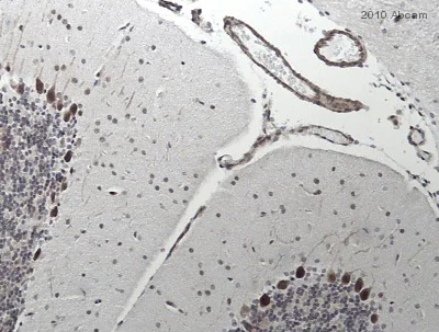 Immunohistochemistry (Formalin/PFA-fixed paraffin-embedded sections) - Anti-Neuropilin 1 antibody [EPR3113] - BSA and Azide free (AB184783)