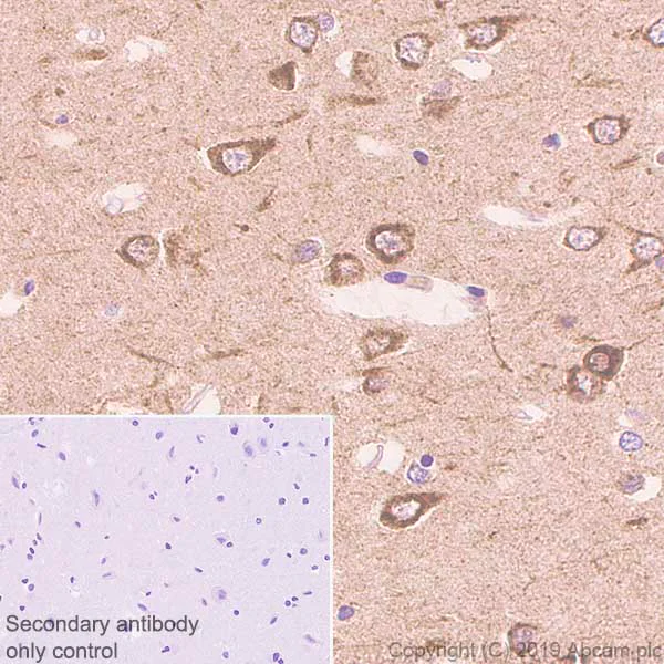 Immunohistochemistry (Formalin/PFA-fixed paraffin-embedded sections) - Anti-Neuroserpin antibody [EPR23329-221] (AB269277)