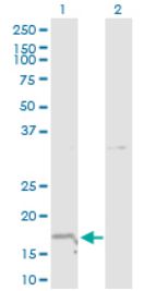 Western blot - Anti-Neurotensin antibody (AB172114), expandable thumbnail