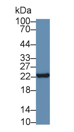 Western blot - Anti-Neurotensin antibody (AB233107)