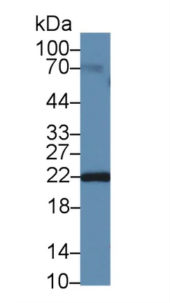 Western blot - Anti-Neurotensin antibody (AB233107)
