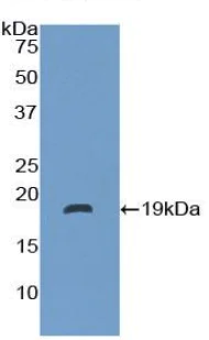 Western blot - Anti-Neurotensin antibody (AB233107)