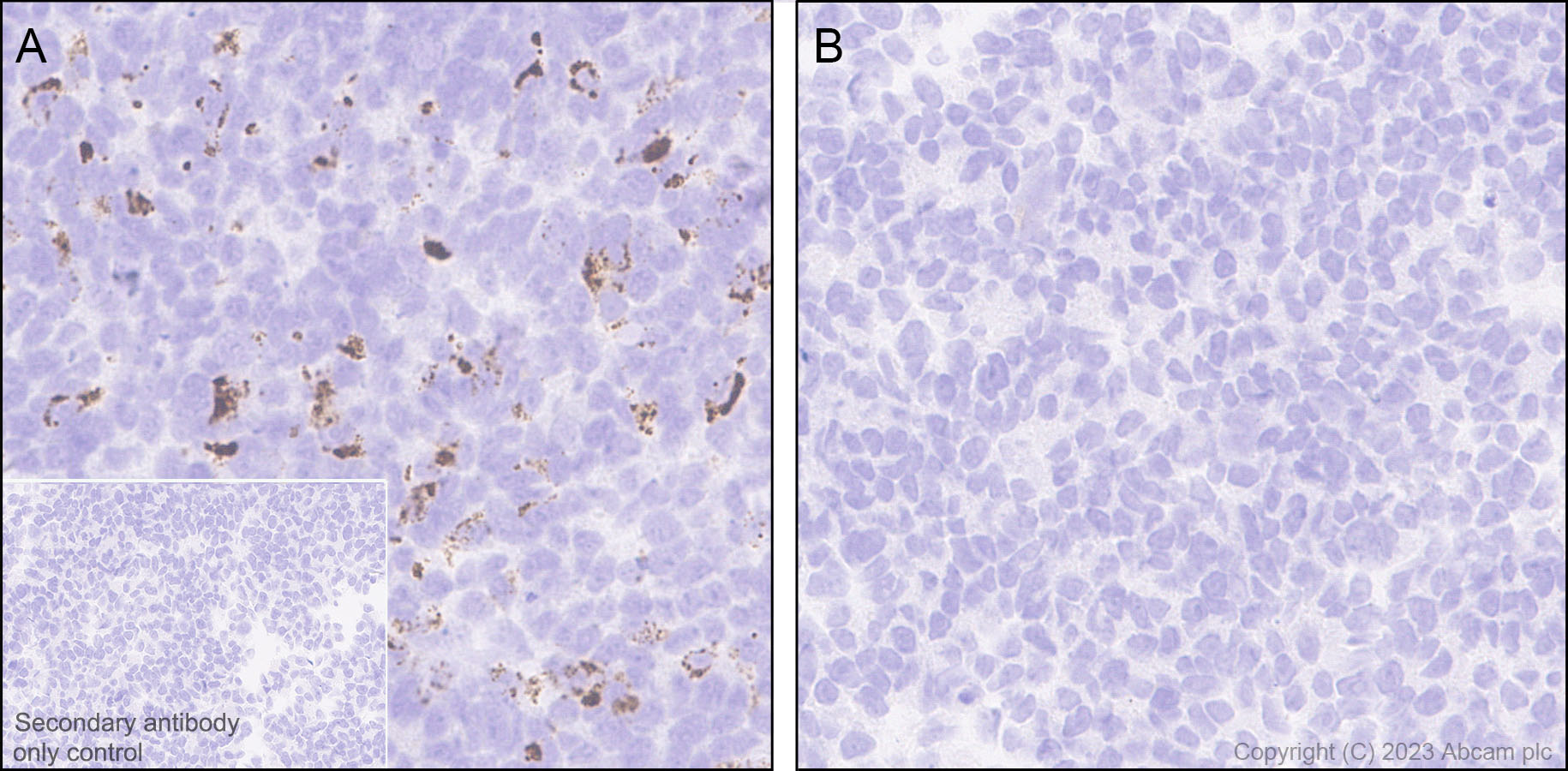 Immunohistochemistry (Formalin/PFA-fixed paraffin-embedded sections) - Anti-Neurotensin antibody [EPR27180-62] - BSA and Azide free (AB308303), expandable thumbnail