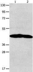 Western blot - Anti-Neurotensin Receptor 1/NTSR1 antibody (AB183088)