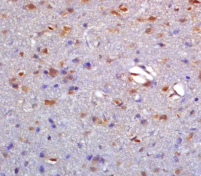 Immunohistochemistry (Formalin/PFA-fixed paraffin-embedded sections) - Anti-Neurotensin Receptor 1/NTSR1 antibody (AB217134)