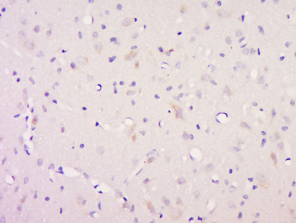 Immunohistochemistry (Formalin/PFA-fixed paraffin-embedded sections) - Anti-Neurotrophin 3 antibody (AB216491)