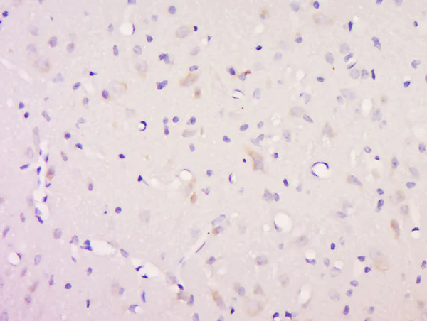 Immunohistochemistry (Formalin/PFA-fixed paraffin-embedded sections) - Anti-Neurotrophin 3 antibody (AB216491)