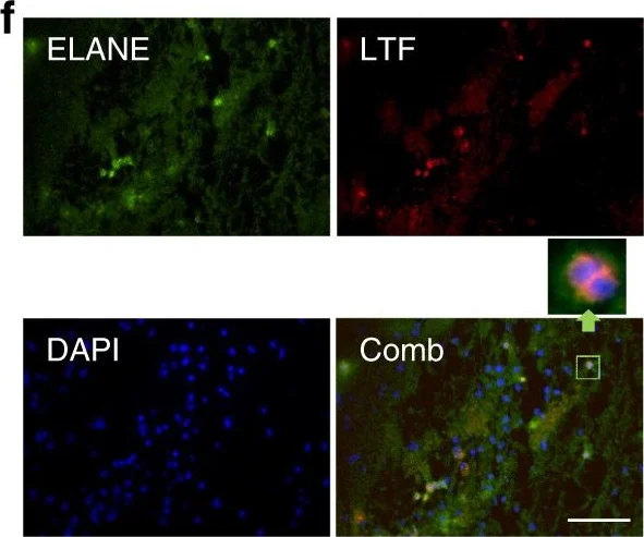 Immunohistochemistry - Anti-Neutrophil antibody [7/4] (AB53457)