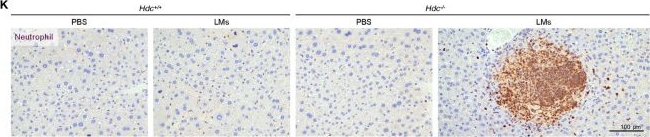 Immunohistochemistry (Formalin/PFA-fixed paraffin-embedded sections) - Anti-Neutrophil antibody [NIMP-R14] (AB2557)