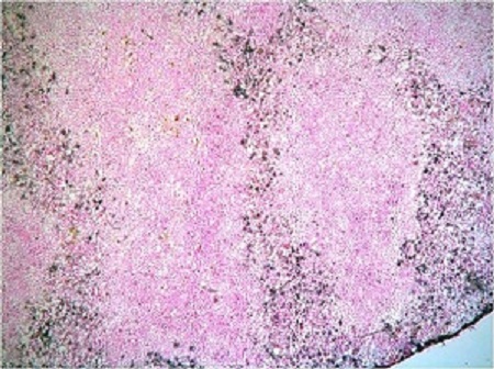 Immunohistochemistry (Frozen sections) - Anti-Neutrophil antibody [NIMP-R14] (AB2557)