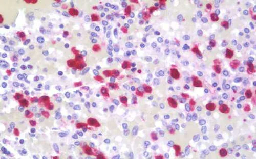 Immunohistochemistry (Formalin/PFA-fixed paraffin-embedded sections) - Anti-Neutrophil defensin 4 antibody - N-terminal (AB192765)