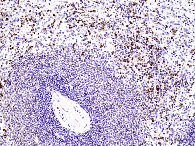 Immunohistochemistry (Formalin/PFA-fixed paraffin-embedded sections) - Anti-Neutrophil Elastase antibody (AB68672), expandable thumbnail