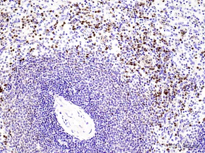 Immunohistochemistry (Formalin/PFA-fixed paraffin-embedded sections) - Anti-Neutrophil Elastase antibody (AB68672)