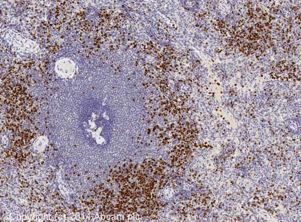 Immunohistochemistry (Formalin/PFA-fixed paraffin-embedded sections) - Anti-Neutrophil Elastase antibody (AB68672), expandable thumbnail