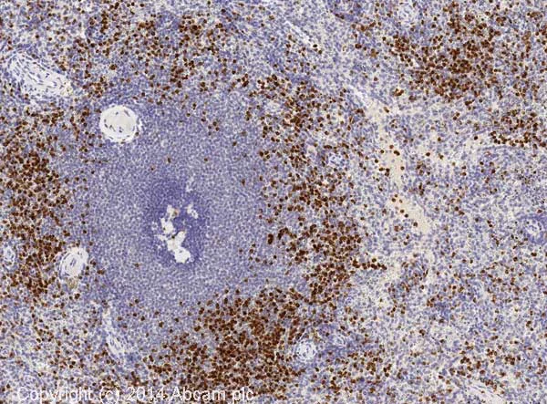 Immunohistochemistry (Formalin/PFA-fixed paraffin-embedded sections) - Anti-Neutrophil Elastase antibody (AB68672)