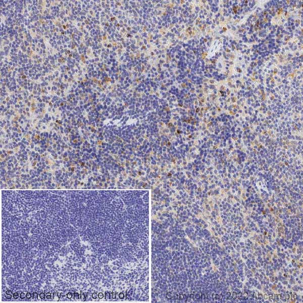 Immunohistochemistry (Formalin/PFA-fixed paraffin-embedded sections) - Anti-Neutrophil Elastase antibody (AB68672), expandable thumbnail