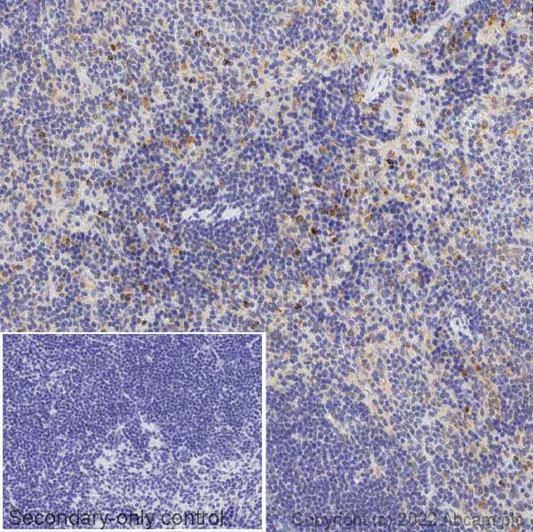 Immunohistochemistry (Formalin/PFA-fixed paraffin-embedded sections) - Anti-Neutrophil Elastase antibody (AB68672)