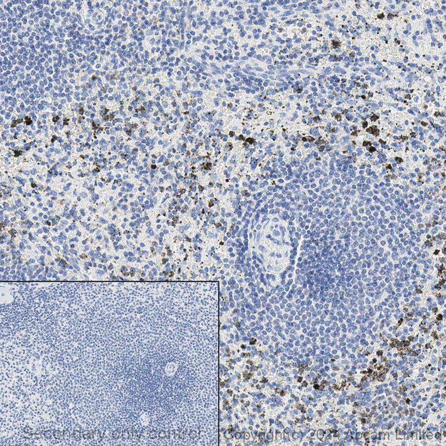 Immunohistochemistry (Formalin/PFA-fixed paraffin-embedded sections) - Anti-Neutrophil Elastase antibody (AB68672), expandable thumbnail